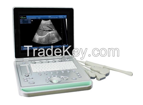 SS-9 PC based laptop digital ultrasound