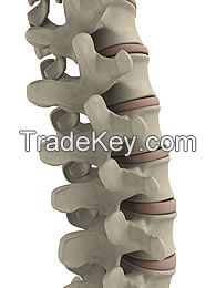 Spinal stretcher