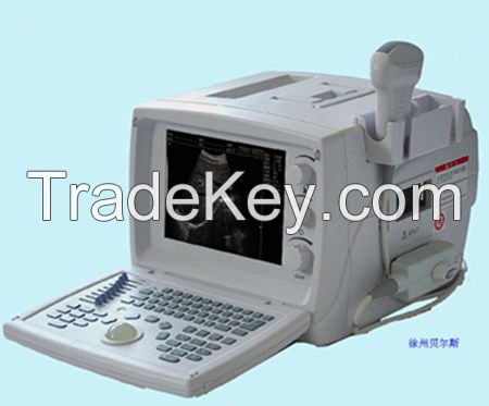 Full Digital Ultrasound Diagnosis System