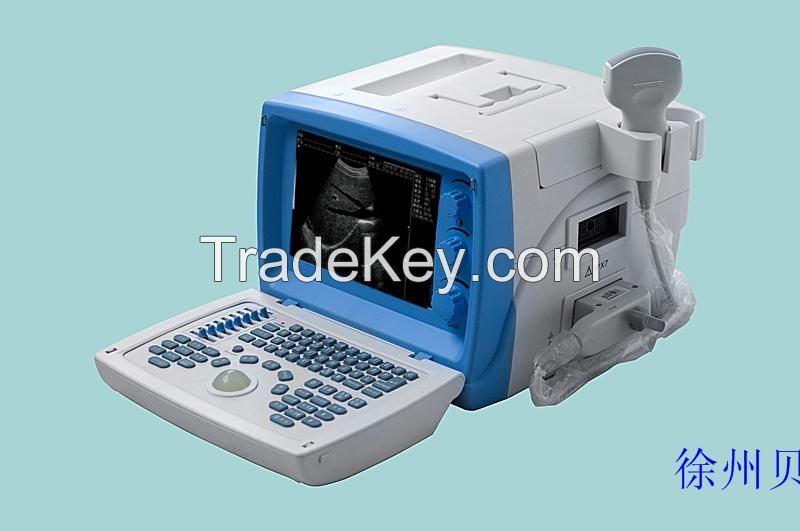 Ultasound Machine Full Digital Ultrasound Diagnosis System