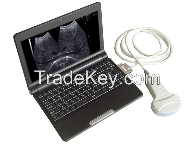 BLSÃ¯Â¼ï¿½810 Laptop Full Digital Ultrasound