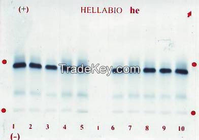 HEMOGLOBIN ELECTROPHORESIS (HE)