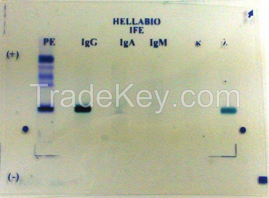 IMMUNOFIXATION ELECTROPHORESIS (IFE)