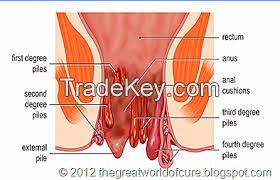 piles Treatment Super Specialty