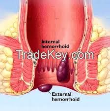 piles Treatment Super Specialty