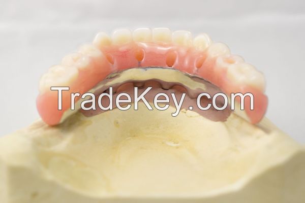 Implant denture