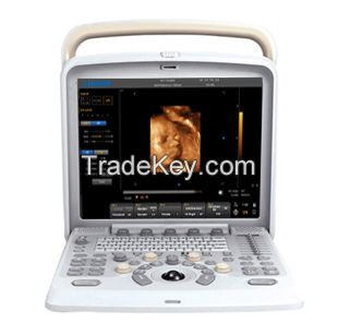 Color Doppler Q5