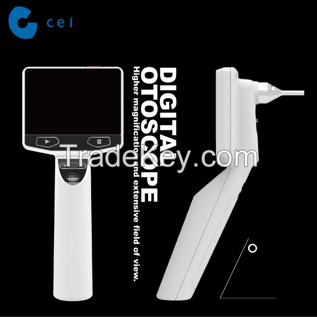 ENT Doctor Endorsed Digital Otoscope New Revolutionary Product Otitis Media Physiotherapy Ear Surgery Set Hospital Equipment
