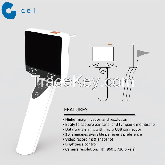 ENT Doctor Endorsed Digital Otoscope New Revolutionary Product Otitis Media Physiotherapy Ear Surgery Set Hospital Equipment