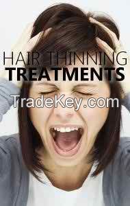  Best hair loss treatment Regenovate in pakistan call-03334838648