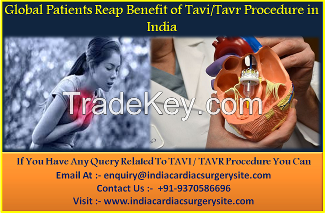 Benefit of Tavi/Tavr Procedure in India At Low Cost