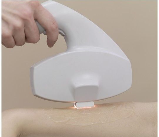 Very good effect SHR ipl hair removal laser CE approved