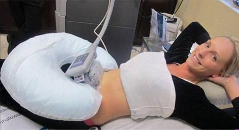 Effective Cryolipolysis weight loss+CE+body slimming+2014 