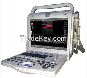 Color doppler ultrasound scanner