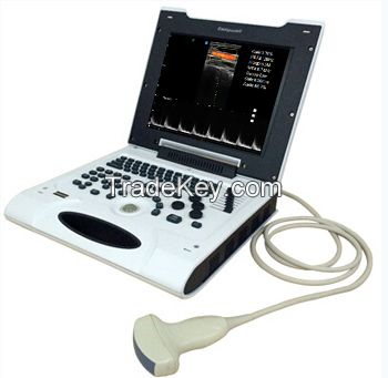 Portable ultrasound scanner color doppler 
