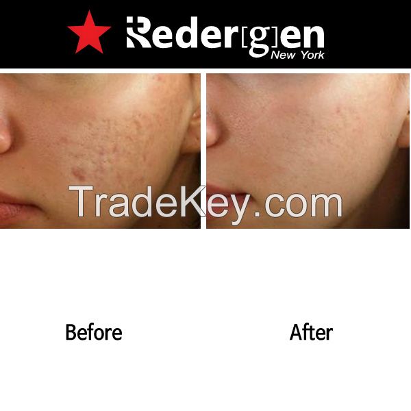 [Redergen] Face Brightening Cream, Whitening Cream, No.1 Aesthetic, Professional, Face, Age Spots, 50g