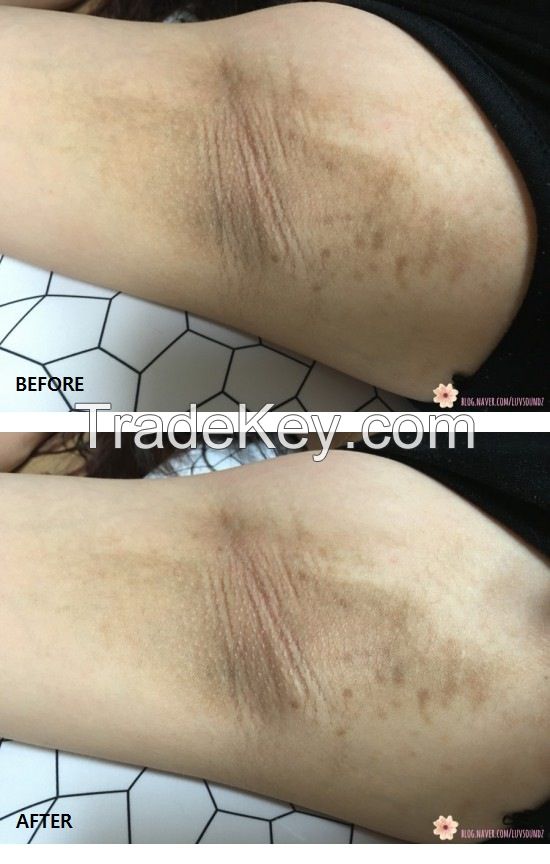 [Redergen] Underarm, Armpit Brightening Bleaching Whitening Cream, No.1 Aesthetic, Professional, 50g