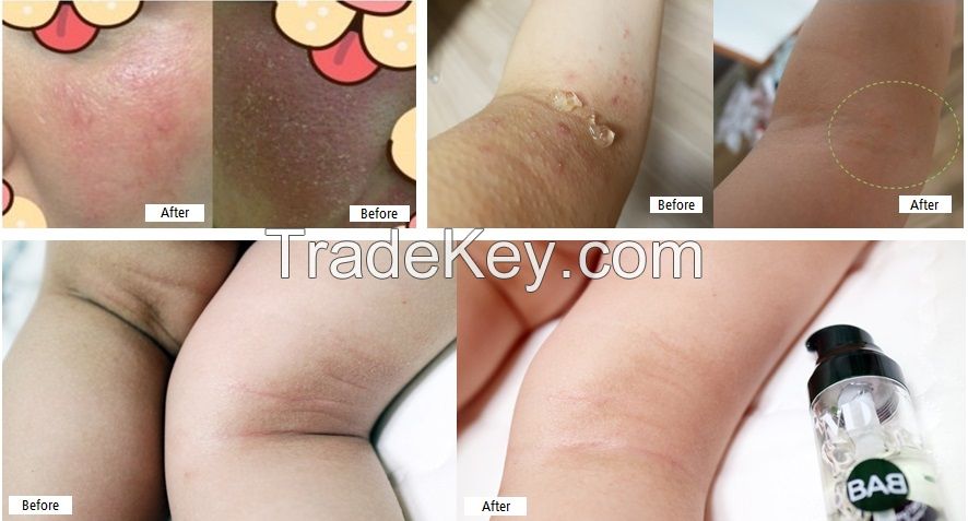 [ATO-BAB] Atopy, Atopic Dermatitis, Eczema, Skincare, Professional, No.1, 80ml
