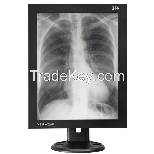 3 MegaPixel high resolution medical display