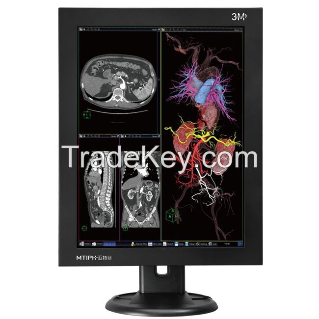  3MP diagnosis color LCD display and monitors