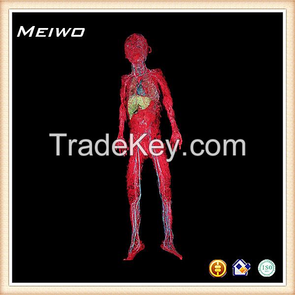 Systemic vascular casting specimens