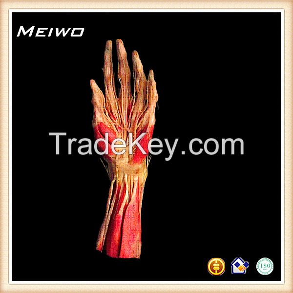 Superficial Hand arteries human plastinated specimens