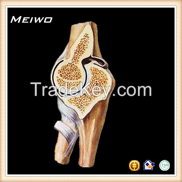 Section of elbow joint buy plastinated specimens