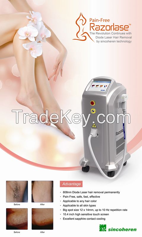 808nm diode laser super hair removal machine