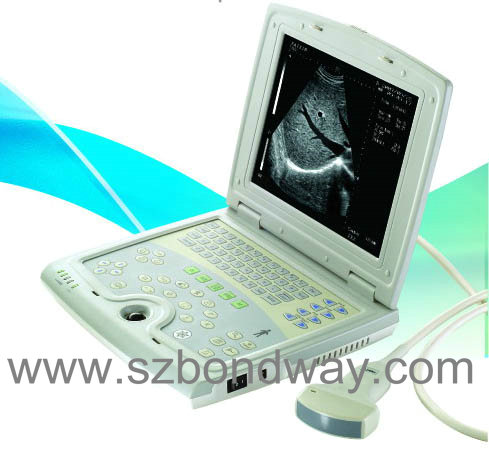 Digital Ultrasound Scanner (BW500)