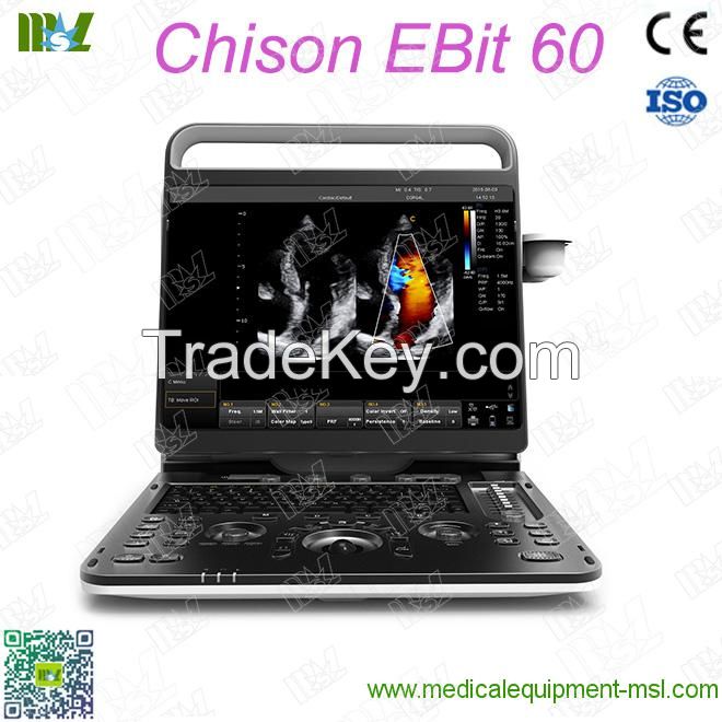 Ecografie endovaginala Chison EBit 60 price