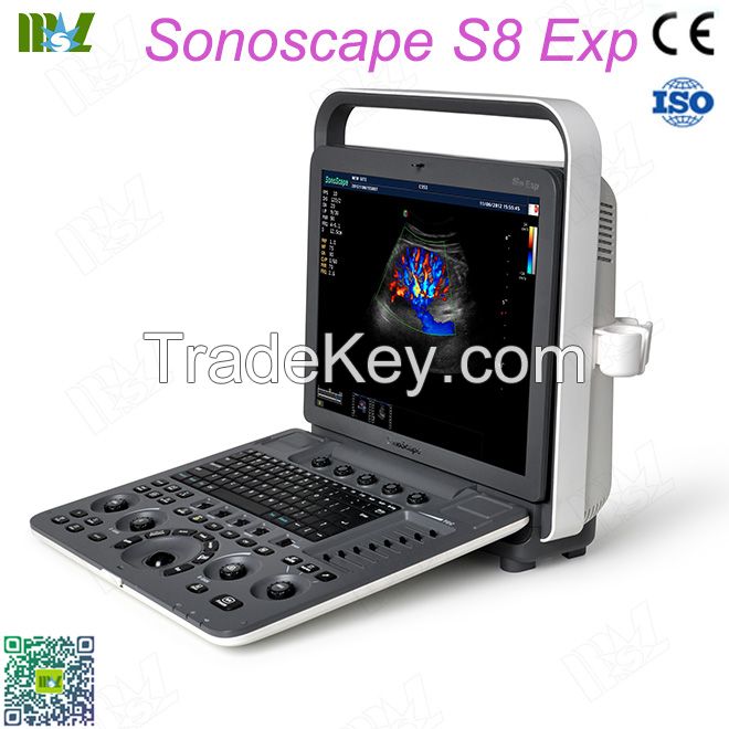 Factory Direct Sales Best Sonoscape Ultrasound Machine S8exp