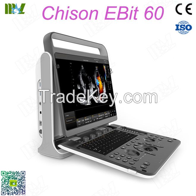 Ecografie endovaginala Chison EBit 60 price