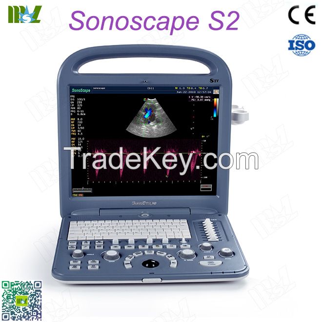 Factory Direct Sales Ecografo Sonoscape S2 Price Lis