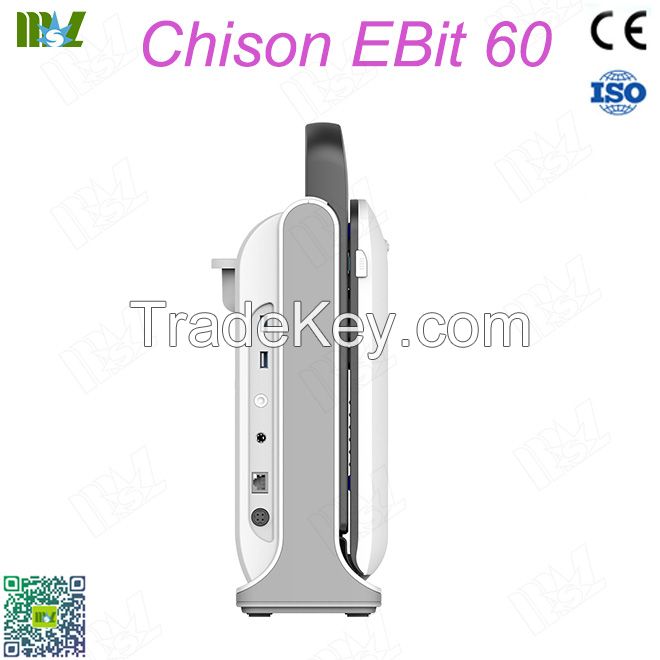 Ecografie endovaginala Chison EBit 60 price