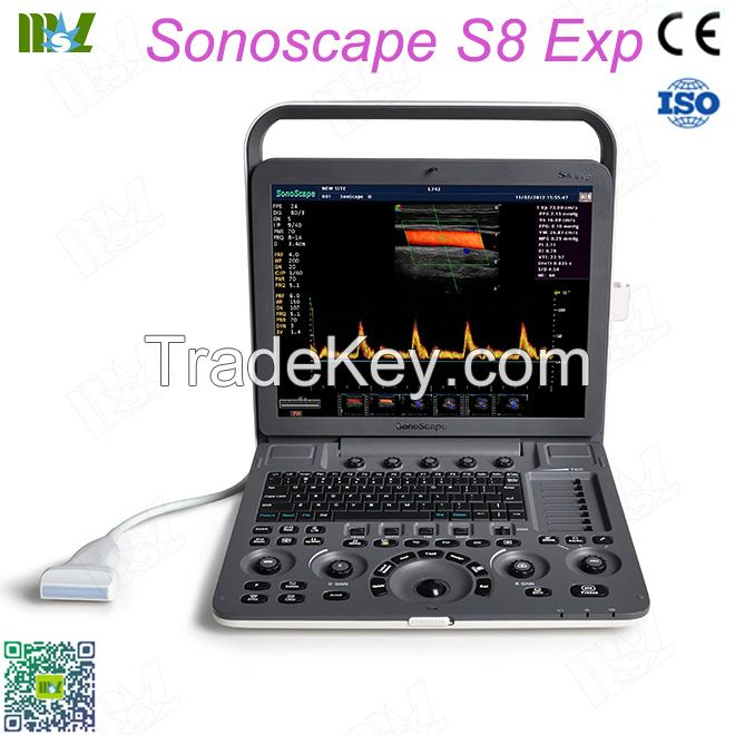 Factory Direct Sales Best Sonoscape Ultrasound Machine S8exp