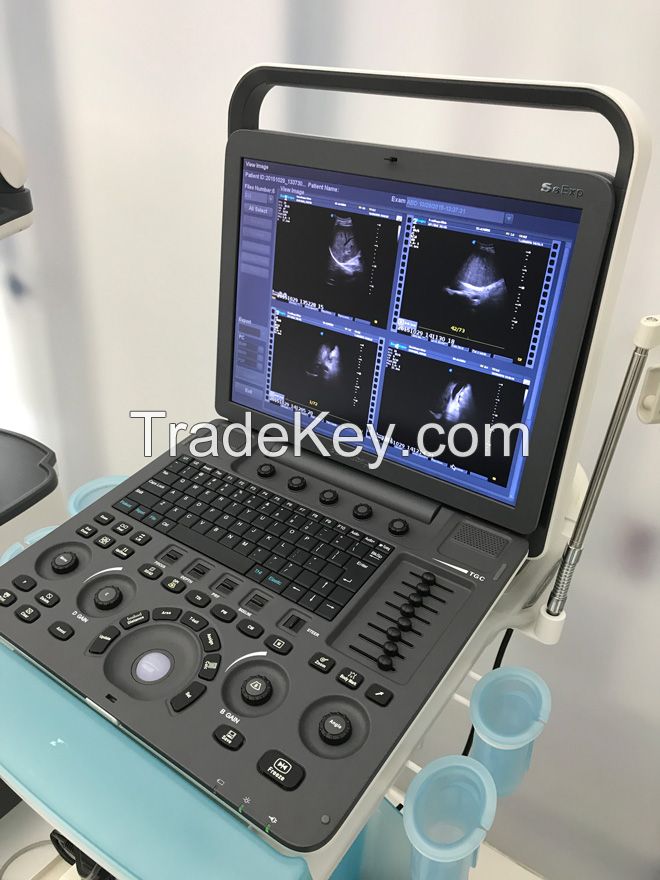 Factory direct sales best sonoscape ultrasound machine S8EXP