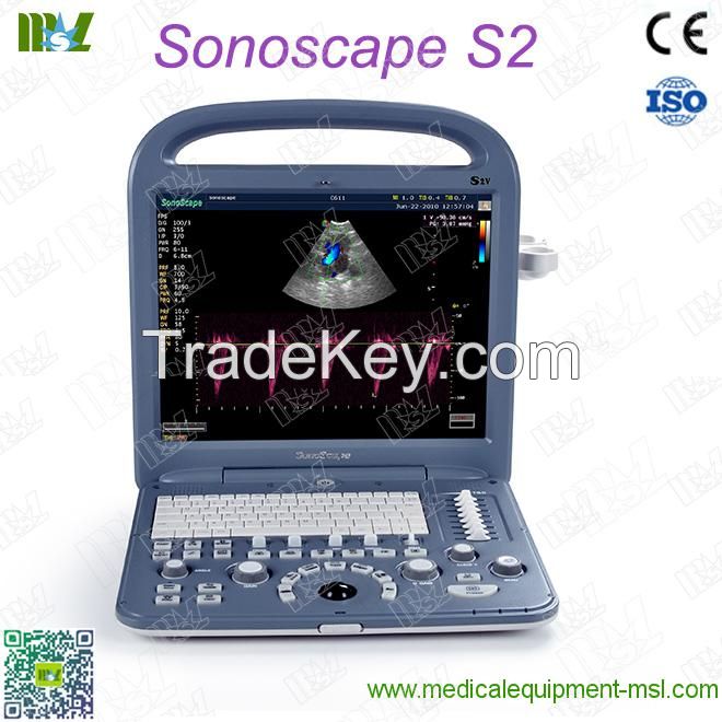 Factory direct sales ecografo sonoscape s2 price lis