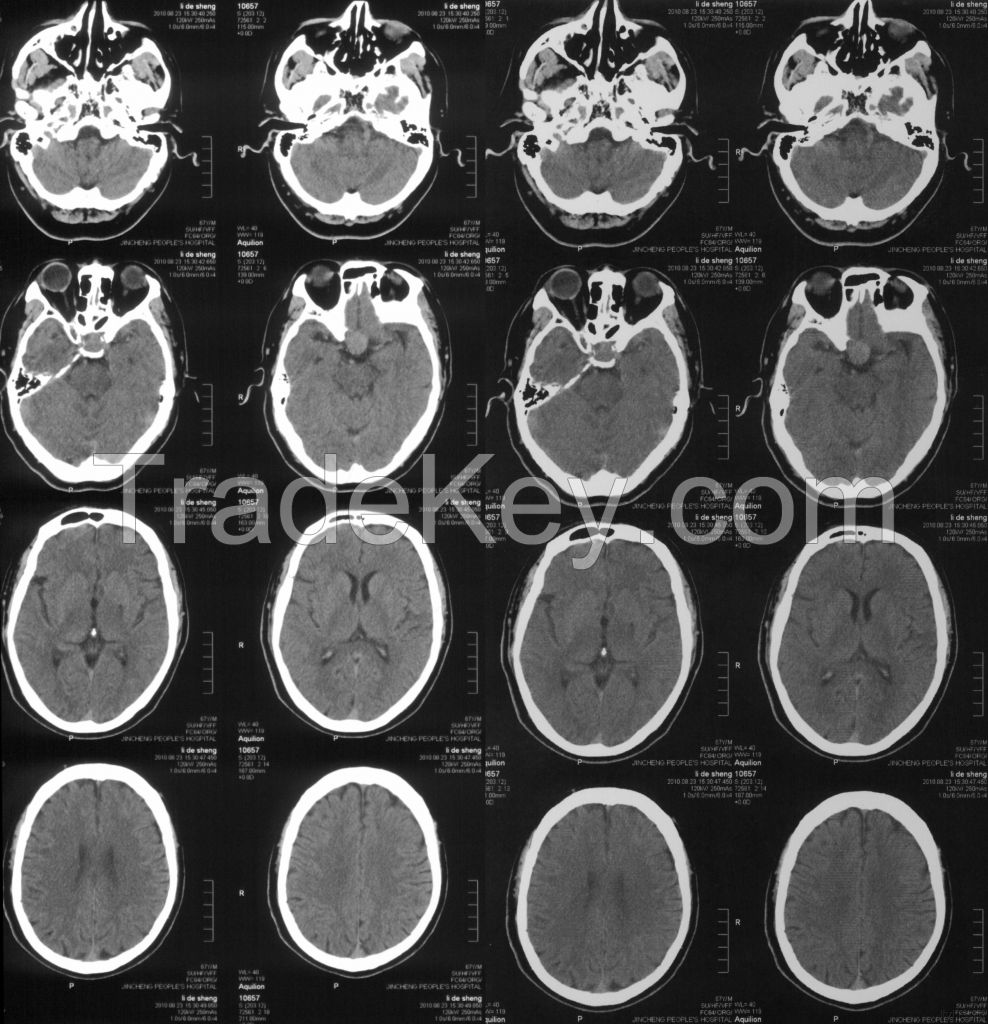 Hot sell medical x-ray film dry film use in hospital