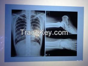 Medical x-ray film hot blue sensitive film for sale