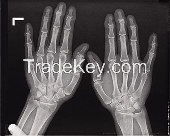 chinese manufacture for medical x-ray films use in hospital 