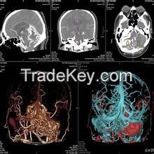 Konida automatic medical x-ray film processor agfa processing machine test equipment