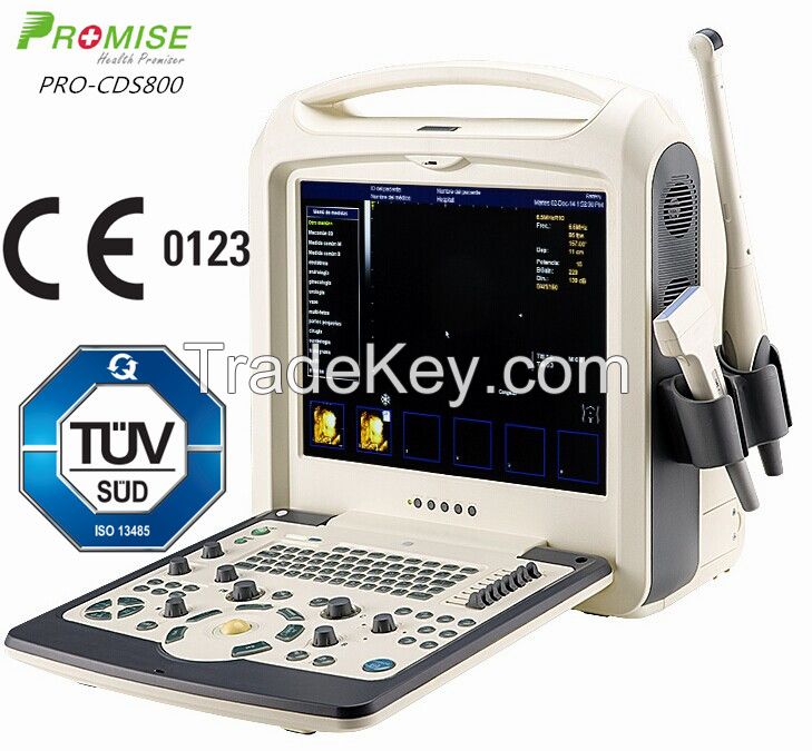 Portable 2D/3D/4D Color Doppler System