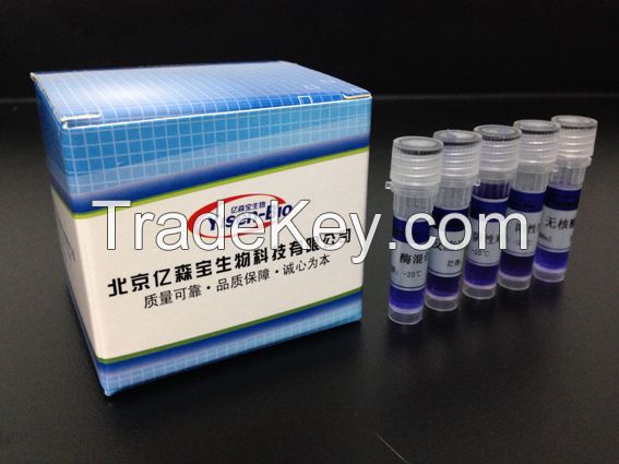 Avian influenza virus (AIV-M) PCR, Elisa kit, diagnosis