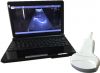 10.1" TFT LED Ultrasound Scanner with Convex Linear Transvaginal Micro Convex Probe