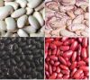 Dark Red Kidney Beans, Red kidney Beans, white kidney Beans, black kidney, light speckled kidney beans