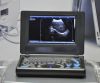 Canyearn A10 Full Digital Laptop Ultrasonic Diagnostic System Black and White Ultrasound Scanner