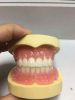 removable denture, dental restorations, dental supplies