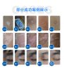 Powerfu Mini 308nm excimer laser 308nm psoriasis vitiligo laser clinical use