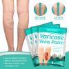 Spider Veins Removal Patch for Legs,Varicose Veins Treatment for Legs,Relieving Pain and Improving Blood Flow