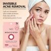 Facial Stickers,Miracle Invisible Spot Cover Hydrocolloid Acne Pimple Patches for Face,Blemishes and Zits